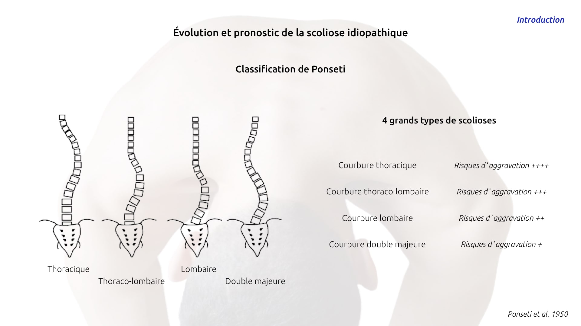 Module La scoliose idiopathique — free download